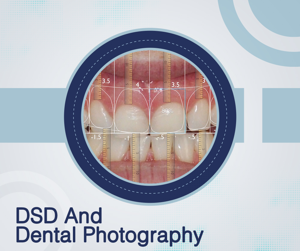 DSD Concepts & Dental Photography