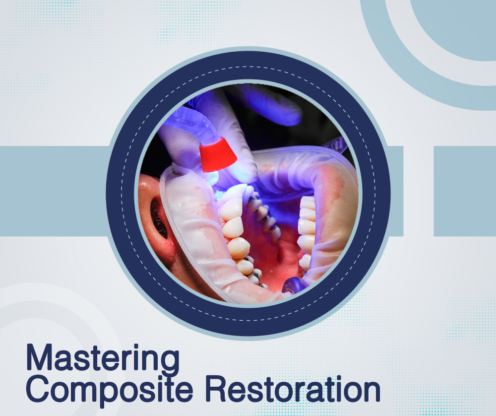 Mastering Composite Restoration